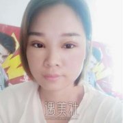 姬东硕双眼皮技术怎么样?热门案例分享~ width=
