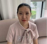 葛志鑫医生有失败案例吗?真实双眼皮案例一览~ width=