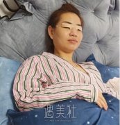 李长赋双眼皮案例分享|果真让人惊讶! width=