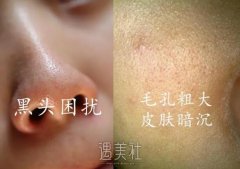 美肤丨 你和“高清脸”的差距只是一次韩国大气泡 width=
