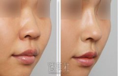 厦门华美整形医院价格表2020优惠(价目表)巨献~ width=