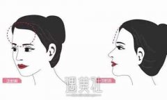 露额显魅力 2招打造饱满额头 width=