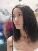 假体隆鼻后鼻子可以捏吗? width=