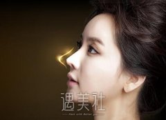 假体隆鼻后何时能够拆线? width=