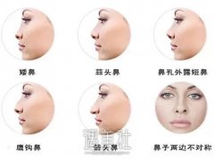 假体隆鼻后皮肤变薄是怎么回事? width=