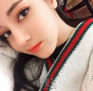 假体隆鼻术后多久就能够消肿呢? width=