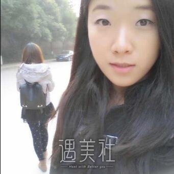 泰安当代整形双眼皮案例|内附真实恢复日记~ width=
