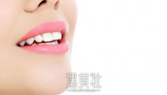 广州瓷贴面怎么样? width=