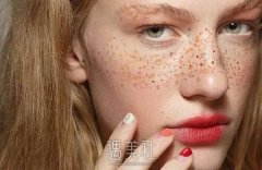 超英祛斑果怎么样? width=