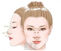 膨体隆鼻恢复时间有多长?怎样设计方案才合理? width=