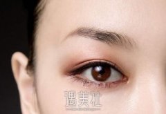 开外眼角疼吗？开外眼角拆线疼吗？持续疼痛怎么办？ width=
