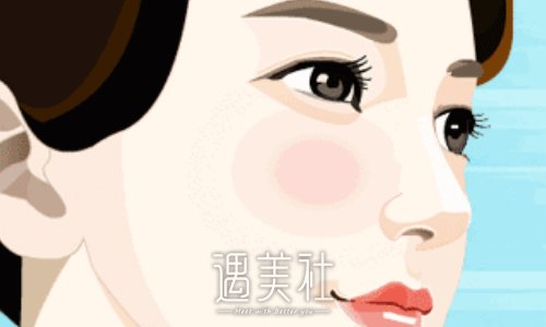 北京李桂珍隆鼻价格贵吗？2022价格表及案例展示 width=