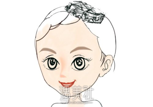 张峰医生做双眼皮怎么样？医生口碑及案例全新一览 width=