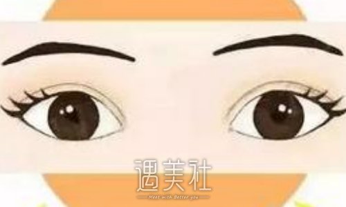 孙强医生割双眼皮靠谱吗？2022招牌案例曝光 width=