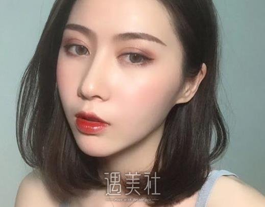 广州苏爱云医生割双眼皮怎么样？医生实力及案例公布 width=