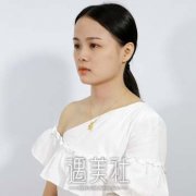 呼市大韩整形怎么样？隆鼻整形失败修复案例鉴赏 width=