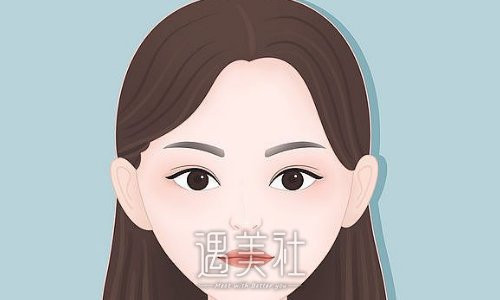 浙江吴慧玲医生激光体验案例公布｜前后对比果让人羡慕 width=