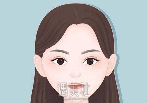 西安张兆祥面部脂肪填充怎么样？医生全新简介及案例一览 width=