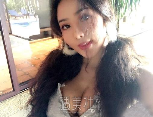 北京美莱谭章梅脂肪丰胸案例展示｜变化前后果图集中一览 width=