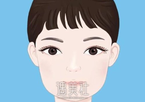 上海王玲医生割双眼皮怎么样？2022全新体验案例一览 width=