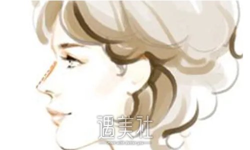 厦门殷佳鹏医生做鼻子怎么样？2022真人体验案例公布 width=