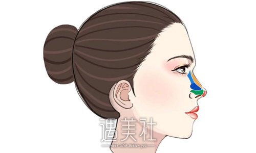 南京刘玉凤医生隆鼻技术怎么样？2022全新体验案例一览 width=