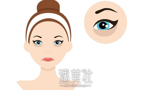 潍坊杨彪炳医生做眼袋怎么样？招牌案例及恢复过程图分享 width=