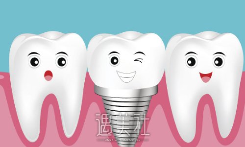 广州曾融生医生种植牙技术靠谱吗？？2022体验案例一览 width=