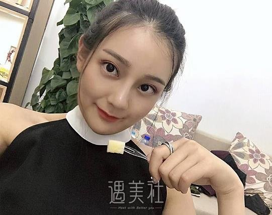 上海罗澜涛做鼻子怎么样？2022招牌案例公布 width=