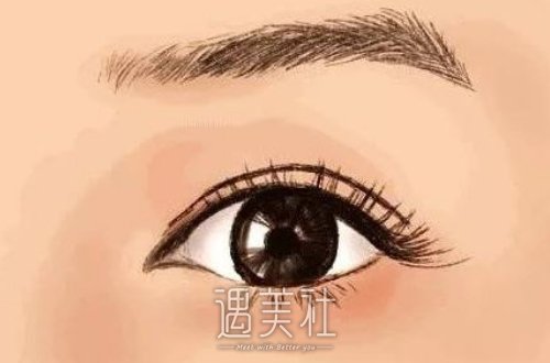 北京于海峰做双眼皮怎么样？2022全新案例展示 width=