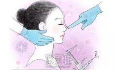 山东朱绚波医生隆鼻案例公开｜内含亲身体验感悟 width=