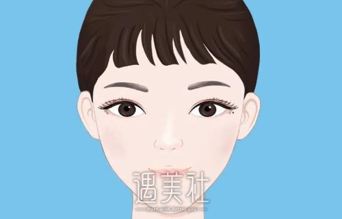 广州赵成利医生面部年轻化案例公开｜附体验对比图 width=