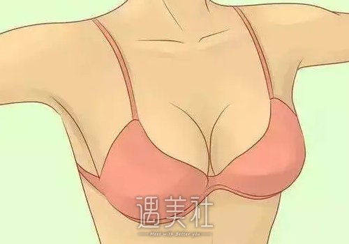 重庆董开云隆胸怎么样？2022招牌案例公布 width=