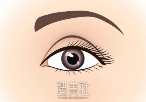 武汉付冰川医生双眼皮案例展示｜附体验果图 width=