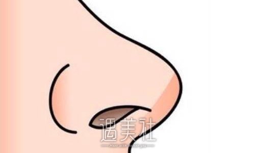 赵兰明医生做鼻子怎么样？医生实力及案例分享 width=