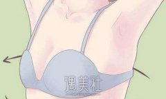 广州刘志刚医生隆胸怎么样？医生实力及案例分享 width=