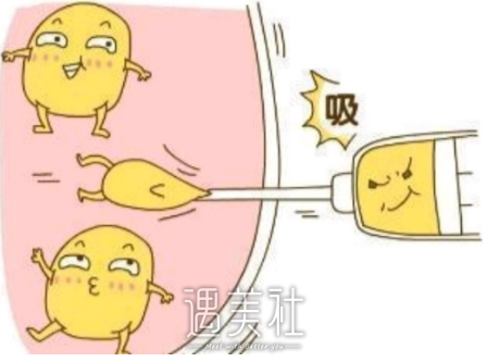 北京李斌斌医生怎么样？吸脂案例及果图出炉 width=