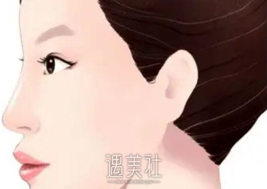 成都李竞医生做鼻子怎么样？2022全新案例分享 width=