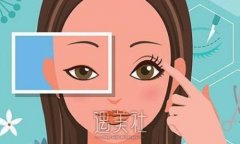 李江医生割双眼皮技术怎么样？招牌案例及果图公布 width=