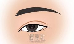 郑州陈龙金医生双眼皮整形案例公布｜附体验详版果图 width=