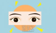 北京王世勇双眼皮修复怎么样？医生实力及案例公布 width=