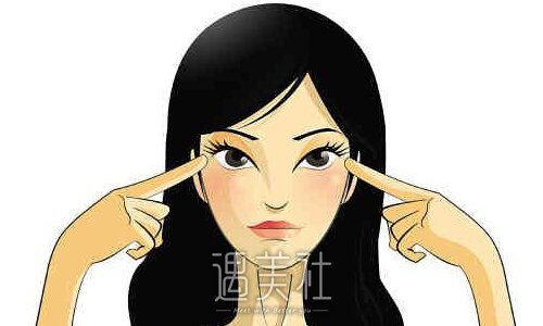 上海张怀军医生双眼皮整形案例出炉｜附90天恢复细节图 width=