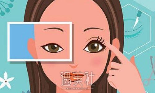 汉中潘会章割双眼皮多少钱？官网收费标准及案例展示 width=