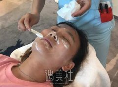 打完的图片，1~7天皮肤质感大变样，超棒 width=