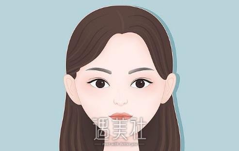 杨明勇医生割双眼皮怎么样？2022全新体验案例公布 width=
