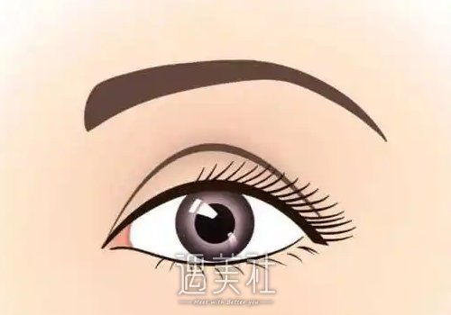 洛阳孔繁荣割双眼皮多少钱？新版收费标准及案例展示 width=