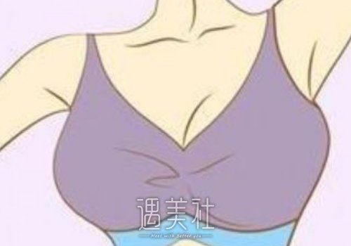 南京李昌医生隆胸靠谱吗？2022医生实力及案例一览 width=