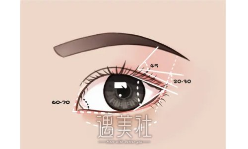 北京郑永生做双眼皮修复价格贵吗？2022招牌案例一览 width=