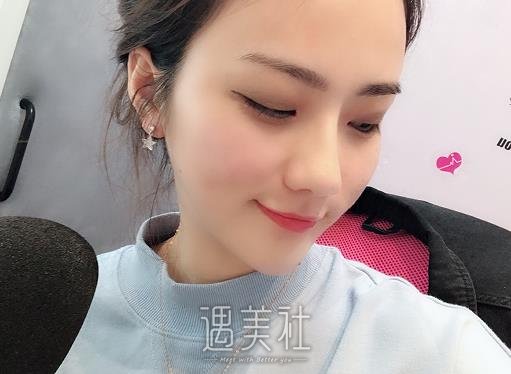 常德曾昭卫医生隆鼻多少钱？2022价格表及案例展示 width=