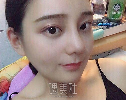 重庆兰宇医生做鼻子怎么样？医生实力及案例出炉 width=